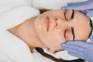 mandelic Acid Peel