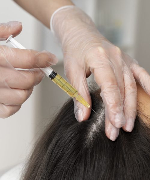 high-angle-woman-getting-scalp-prp-treatment